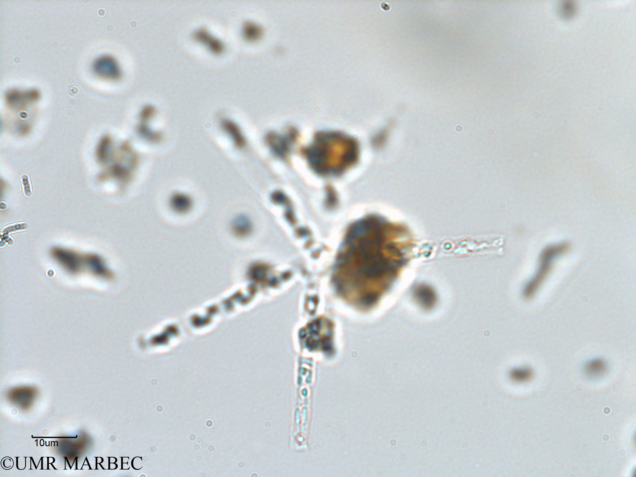 phyto/Bizerte/bizerte_lagoon/RISCO February 2015/Thalassionema sp3 cf nitzschioides (ancien Lagune_T1-B_Thalassionema sp3 cf nitzschioides -3).tif(copy).jpg